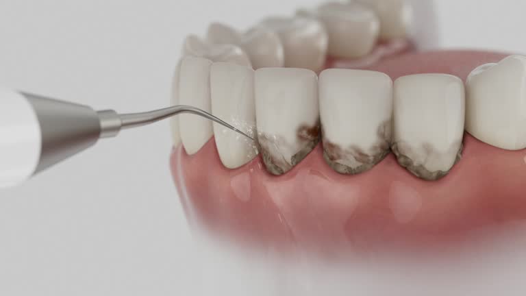 Reliable Dental contractor in Batesville, TX by Smile Center Dentistry